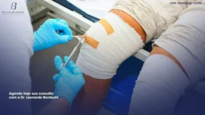 Mês de Prevenção: Cuidados Essenciais com o Joelho